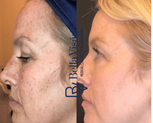 Bella SmoothGlo Client bella-smoothglo-2