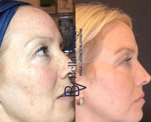 Bella SmoothGlo Client bella-smoothglo-3