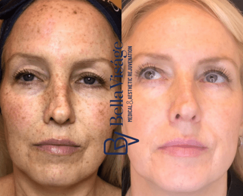 Bella SmoothGlo Client bella-smoothglo-1