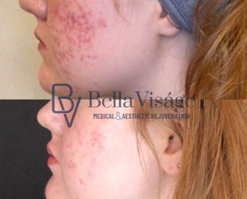 bella-visage-lakeland-rf-b-a-1