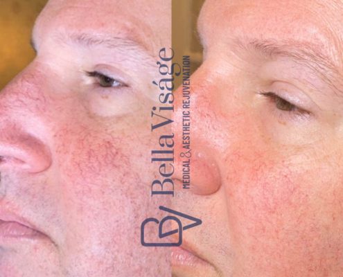 bella-visage-lakeland-rf-b-a-13