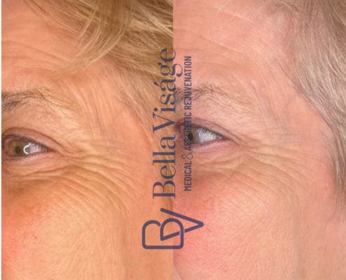bella-visage-lakeland-rf-b-a-6