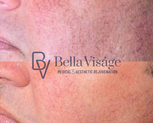 bella-visage-lakeland-rf-b-a-7