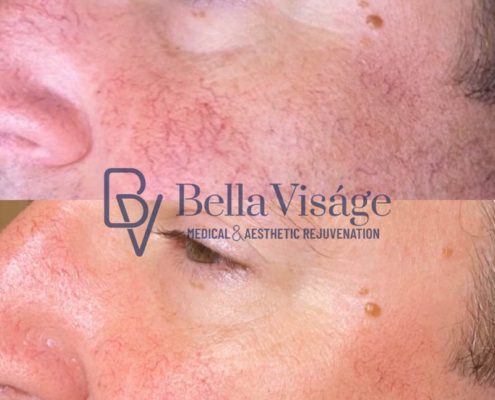 bella-visage-lakeland-rf-b-a-8