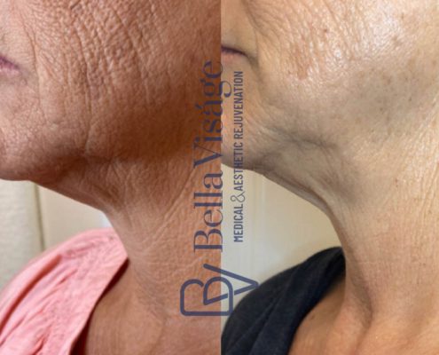 bella-visage-lakeland-rf-b-a-9