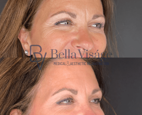 bella-tox-ba-3