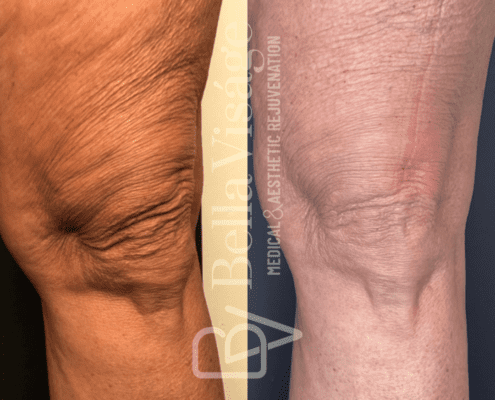 coolpeel-march2025-1-min