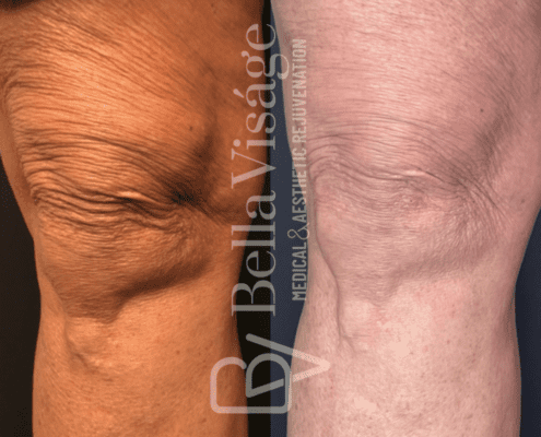 coolpeel-march2025-2-min