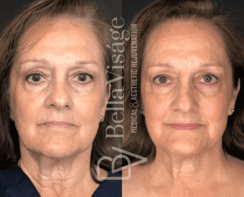 ipl-bella-march2025-1-min