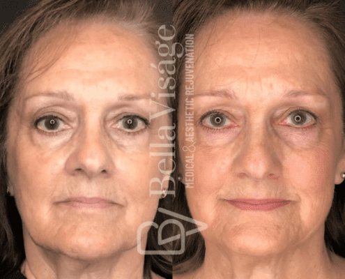 ipl-bella-march2025-2-min