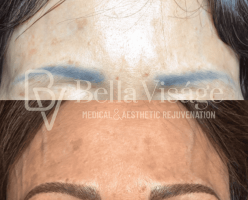 microblading-bella-march2025-1-min