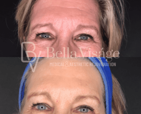 coolpeel-april2025-1-min