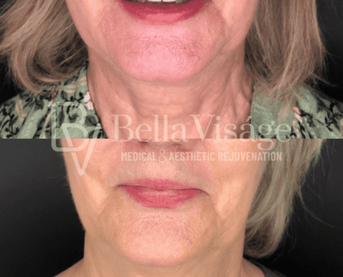 coolpeel-april2025-2-min