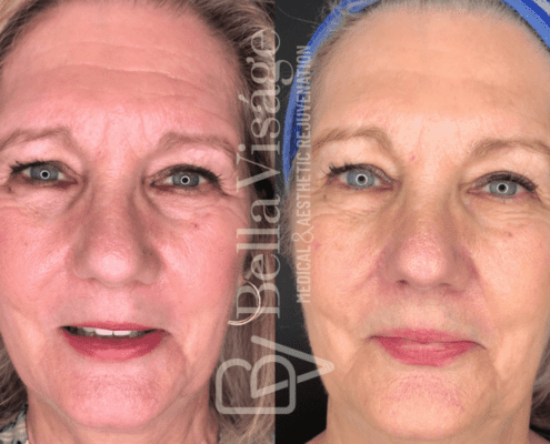 coolpeel-april2025-3-min