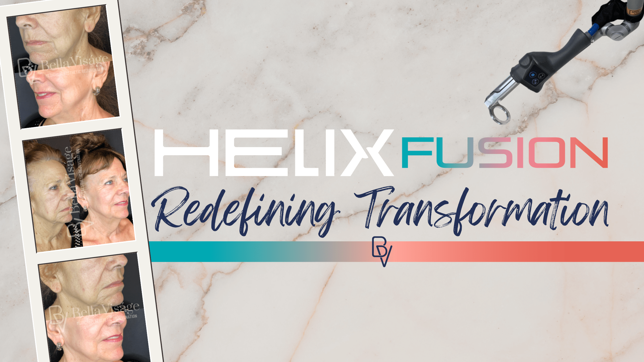 HelixFusion-blogpost-featuredimage-min Laser Tattoo removal in Lakeland