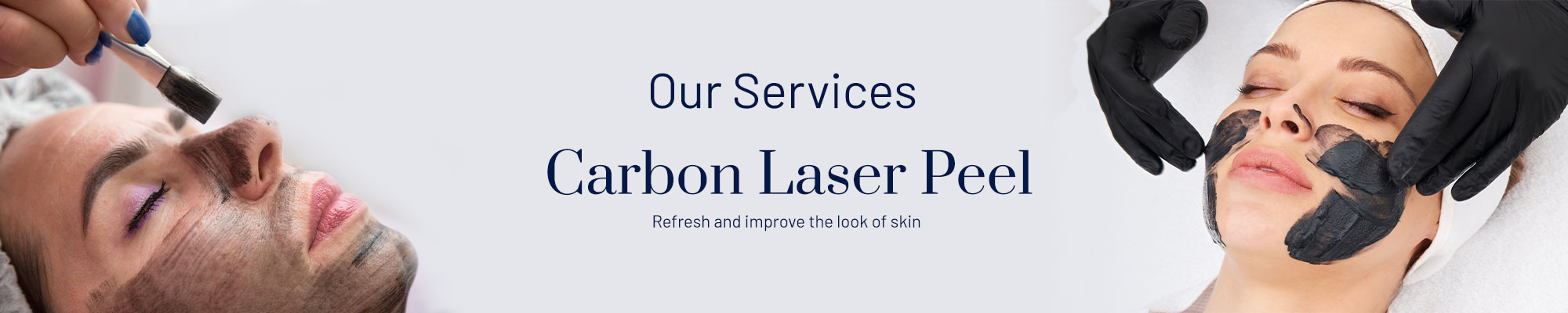 2025-bella-Carbon-Laser-Peel-banner