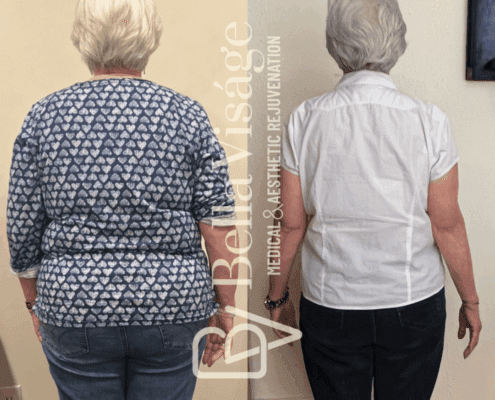 Healthy Weight Loss Lakeland -1 -min