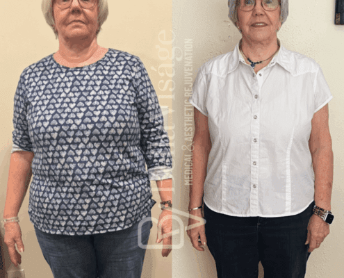 healthy Weight loss lakeland - 3-min